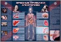 Электрифицированный стенд "Вредные привычки: алкоголизм" - fgospostavki.ru - Ижевск
