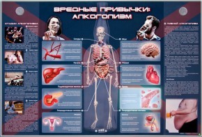 Электрифицированный стенд "Вредные привычки: алкоголизм" - fgospostavki.ru - Ижевск